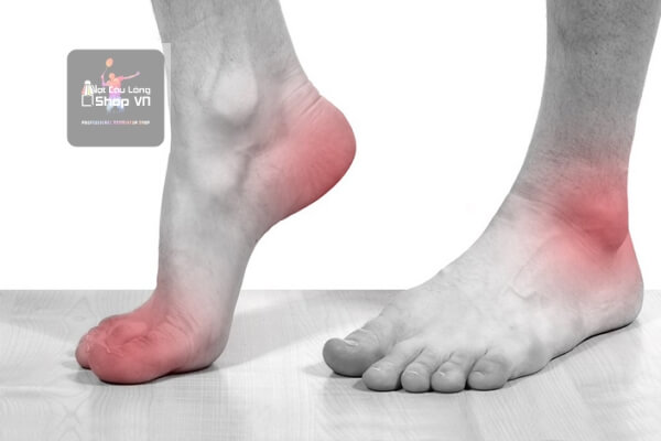 Chơi cầu lông đau cổ chân